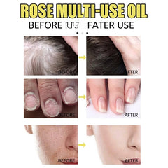 "Rose Petal Essential Oil Moisturizing Serum for Body, Skin, Hair, and Nails - Foot Care for Repairing Dry, Cracked, and Chapped Skin"