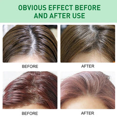 50Ml Volumizing Hair Spray Oil Control Fluffy No-Wash Hair Increase Hair Volume Styling Unisex Salon Care Beauty Styling Product