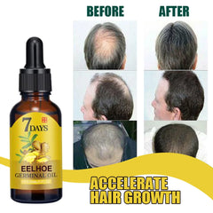 Hair Growth Serum for Effective Baldness Treatment and Fast Regrowth - Repair Damaged Hair and Scalp with Ginger Oil - Ideal for Women and Men