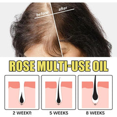 "Rose Petal Essential Oil Moisturizing Serum for Body, Skin, Hair, and Nails - Foot Care for Repairing Dry, Cracked, and Chapped Skin"