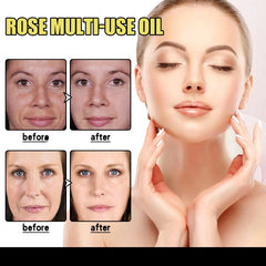"Rose Petal Essential Oil Moisturizing Serum for Body, Skin, Hair, and Nails - Foot Care for Repairing Dry, Cracked, and Chapped Skin"