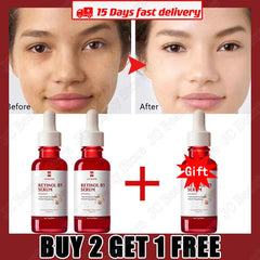 Retinol Wrinkle Remover Face Serum Instant Firming Lifting Anti-Aging Liquid Fade Fine Lines Whitening Korean Skin Care Products