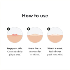 "Acne Treatment Patch Stickers for Chin, Blemish Spot Face Repair, Waterproof Skin Care - 36 Patches"