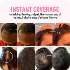 Hairline Repair Filling Powder for Fluffy Thin Hair - Root Up Powder with Forehead Shadow, Concealer for Healthy Hair Makeup - Ideal Gift