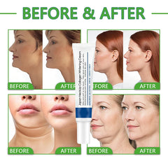 Collagen Repair Neck Cream Anti-Aging Lifts Neck Chin Efficient Reducing Fine Line Moisturizing Whitening Skincare 2024