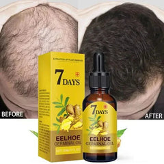 Hair Growth Serum for Effective Baldness Treatment and Fast Regrowth - Repair Damaged Hair and Scalp with Ginger Oil - Ideal for Women and Men