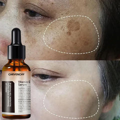 Vitamin C Facial Serum for Firming, Brightening, and Hydrating Skin