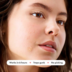 "Acne Treatment Patch Stickers for Chin, Blemish Spot Face Repair, Waterproof Skin Care - 36 Patches"