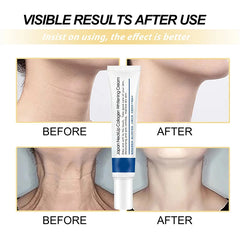 Collagen Repair Neck Cream Anti-Aging Lifts Neck Chin Efficient Reducing Fine Line Moisturizing Whitening Skincare 2024